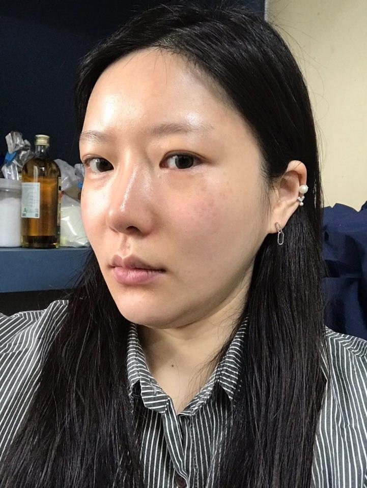 30대가 넘었지만 동안 소리듣는데는 리프팅효과가 톡톡한듯 합니다 ㅎ​