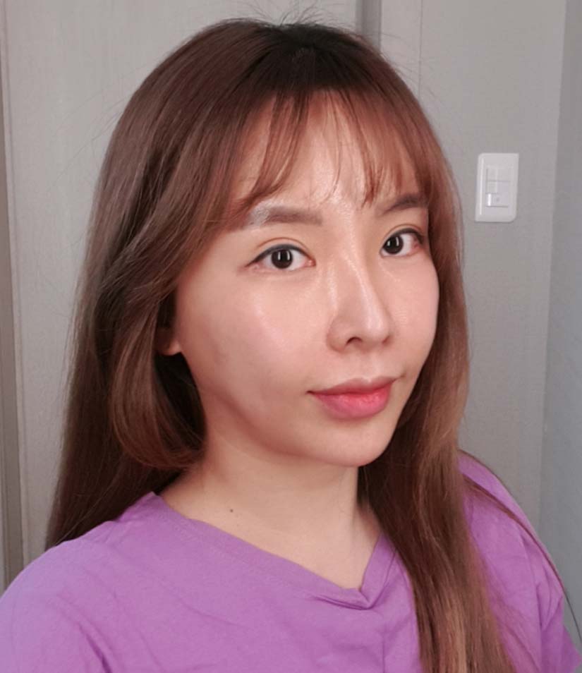 가슴이랑 이중턱지흡, 풀페이스지방이식,리프팅했습니다.