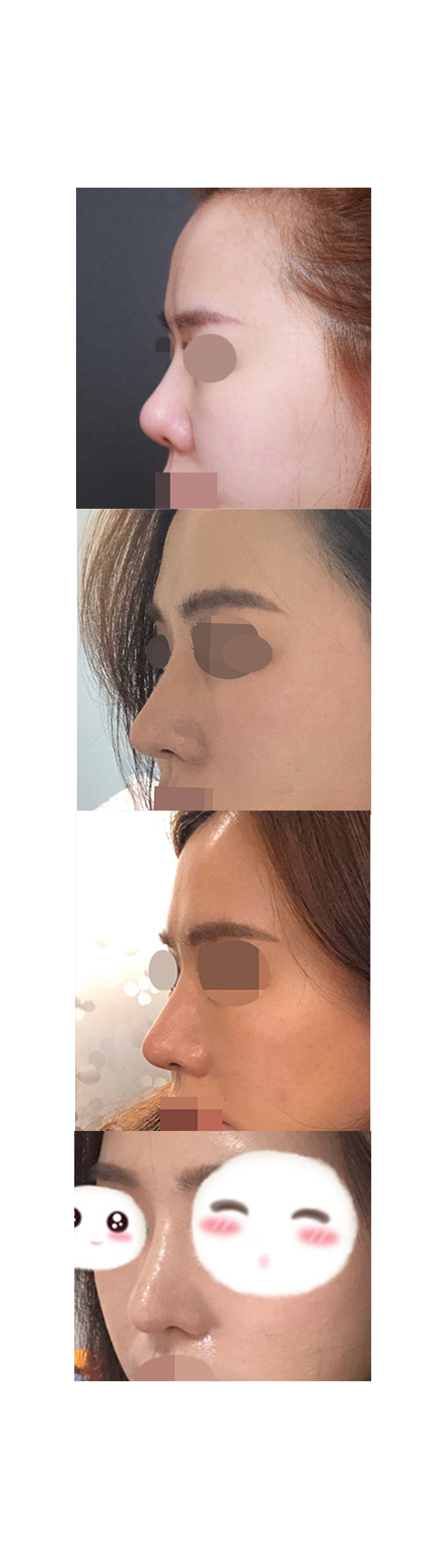 주변에서 자연스럽다고 한게 훨씬 낫다고 많이들 말해요