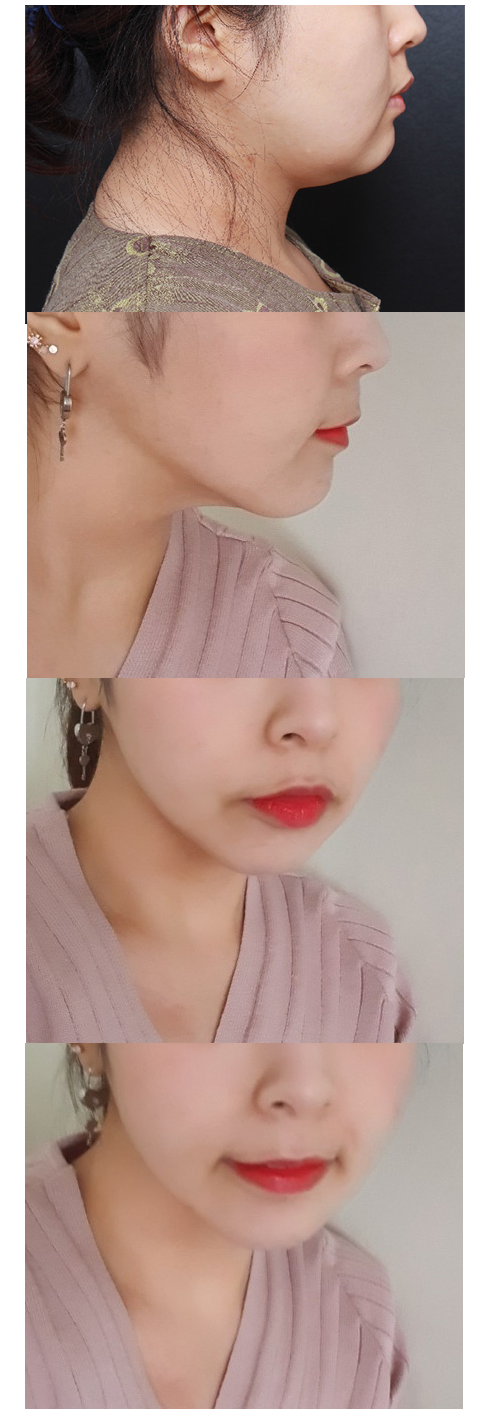 앞으로도 잘 관리할게욤 !! 원장님 감사합니다!!