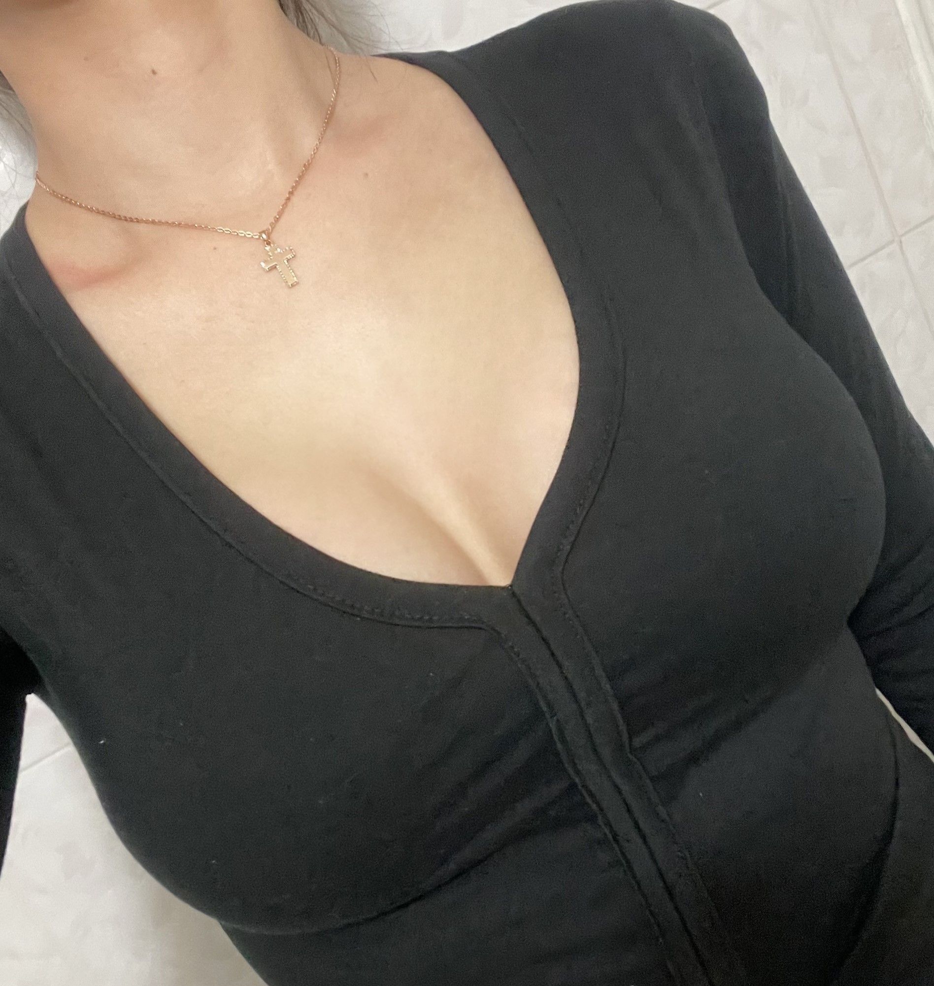 가슴수술 2주차 모티바 찐후기 380CC