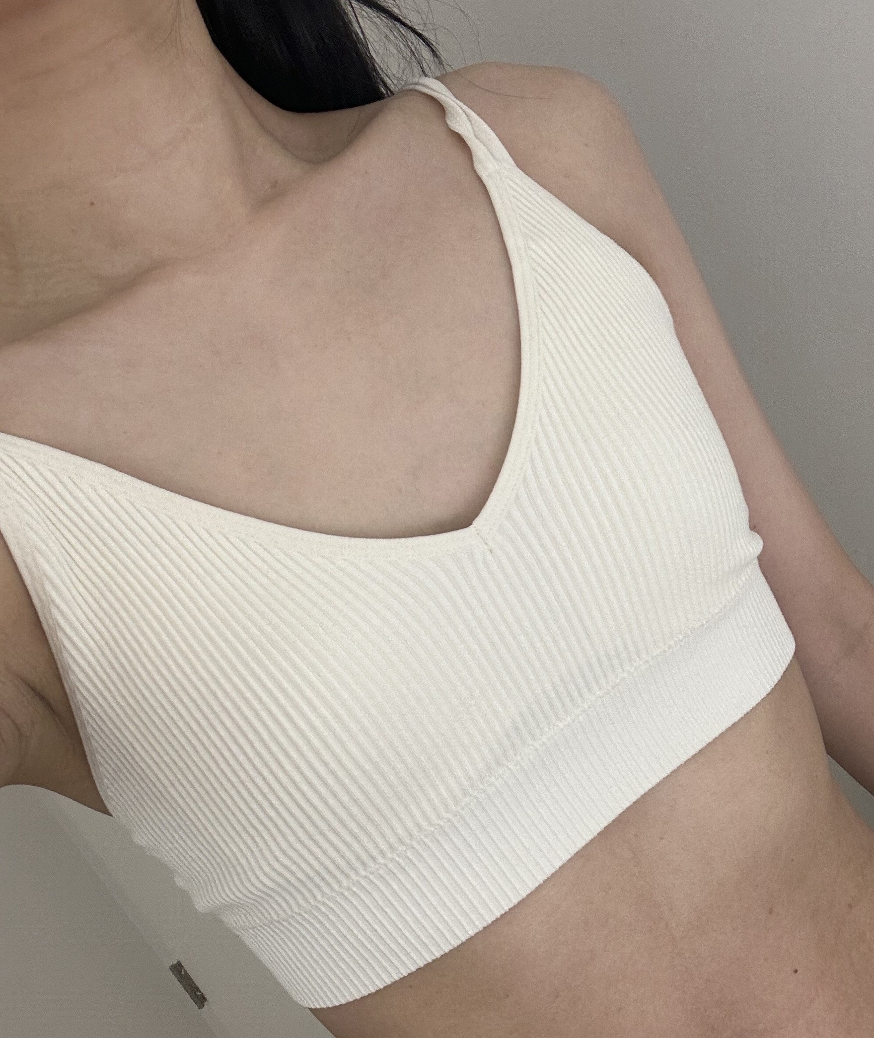 수술 2개월차 후기 올립니다