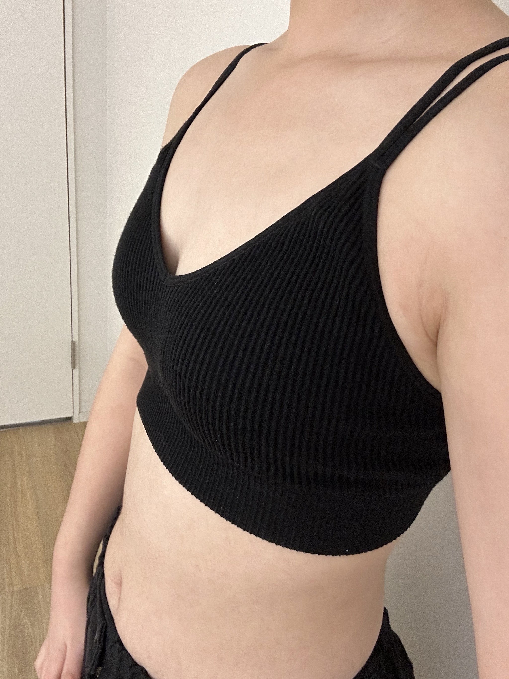 멜론 가슴 수술 두달차 후기