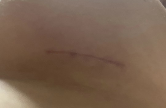 내 가슴모양에 맞게 솔직하게 상담해주셔서 예약했어요☺️