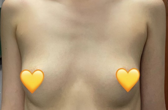 #예쁜 속옷 #캡나시 입는 맛에 산답니다