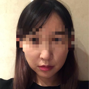 ジェイジュンでフェイスリフトを受け、3週目に入りました。