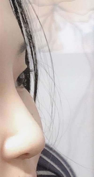 [鼻] トゥルル!! - 鼻