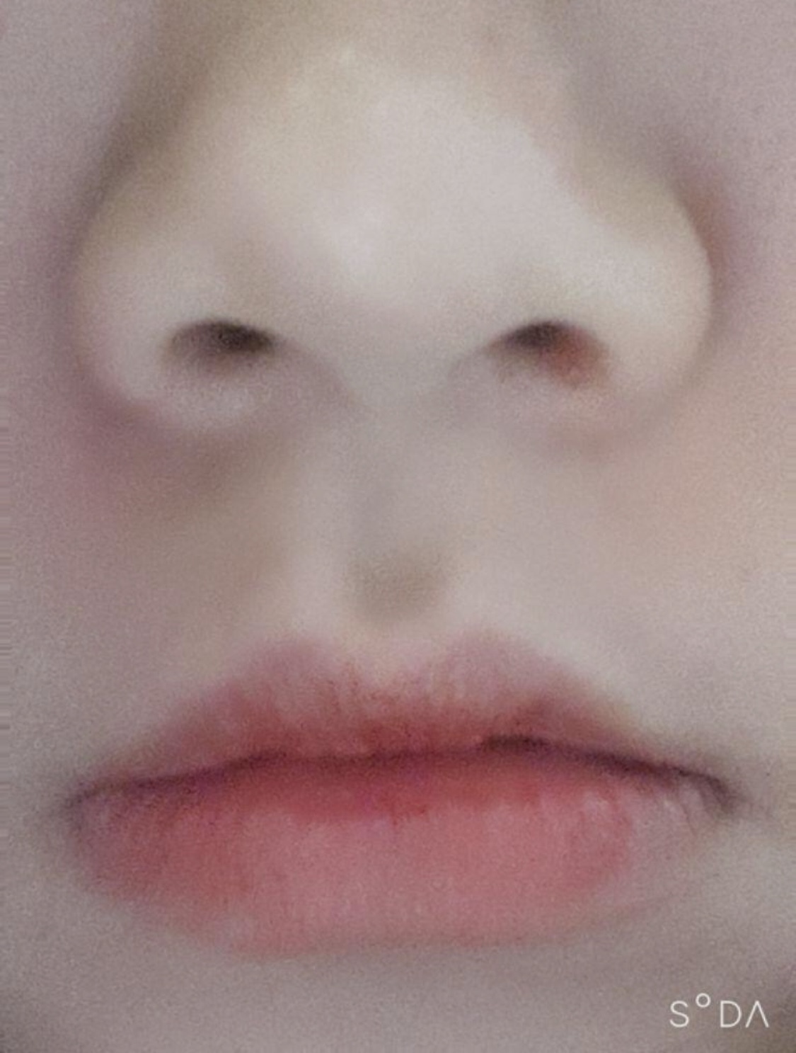 [プチ] ds0405 - ボトックス