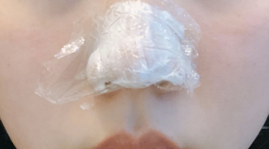 [プチ] プリュリ - ボトックス、鼻先