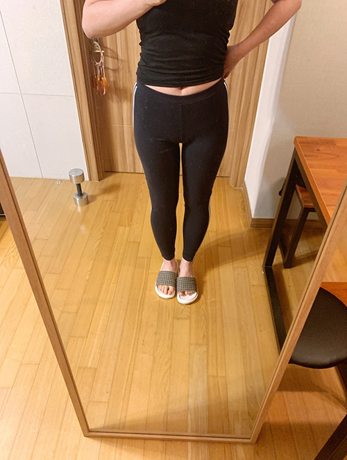 [脂肪吸引] asura87 - 全身脂肪吸引