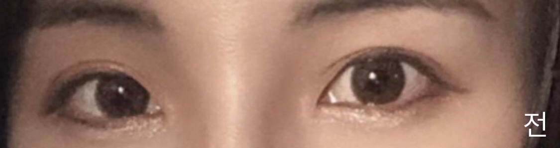 [目] トリニティ91 - 目