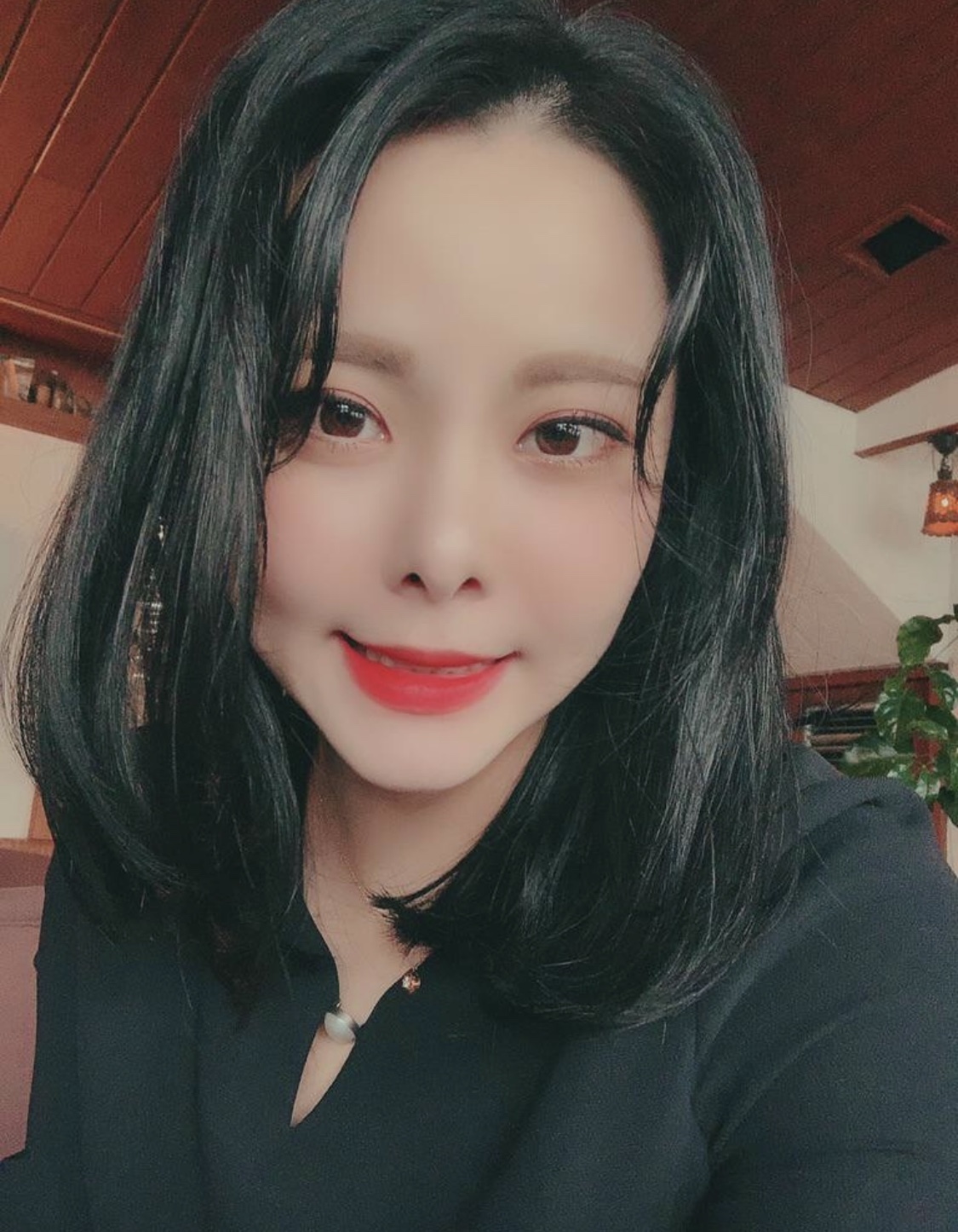 [目] songi1938 - 目尻切開、グラマラスライン形成