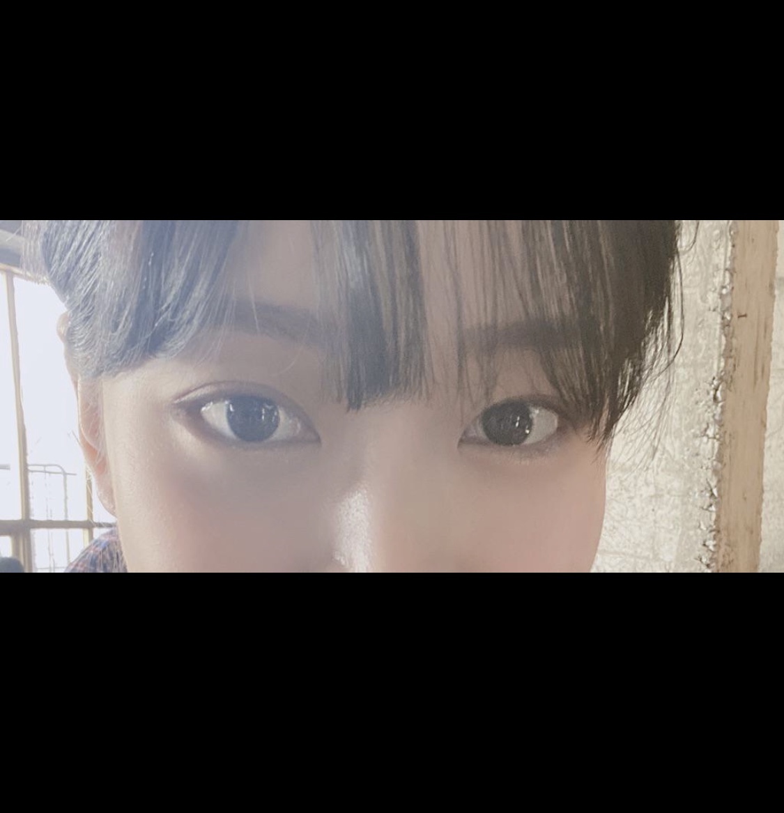 [目] yong0423 - 目尻切開、タレ目形成