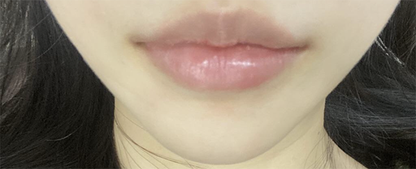 [プチ] ヒヒ헣 - 唇