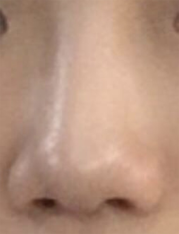 [プチ] dbwladl - 鼻