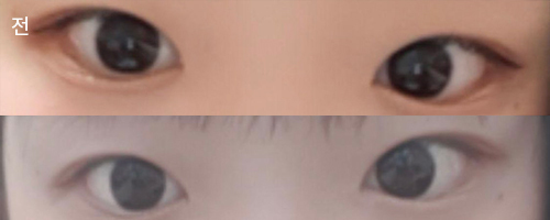 [目] シン・ウンソです - 目