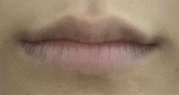 [プチ] チクィーンス - 唇