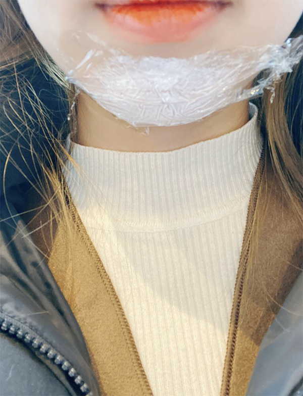 [プチ] ふっくらアゴ - 顎先フィラー、ボトックス