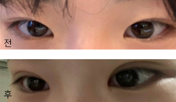 [目] チョキ1234 - 目