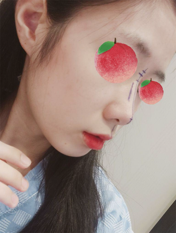 [鼻] ドゥドゥスムージー - 鼻