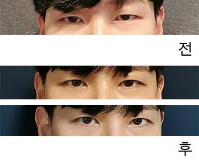 [目] WDHH - 目つき矯正