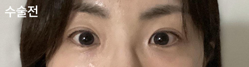 [目] ㅈㅎㅊ - 目