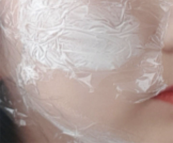 [皮膚] 黄土토리 - ウルセラ、シャネル注射