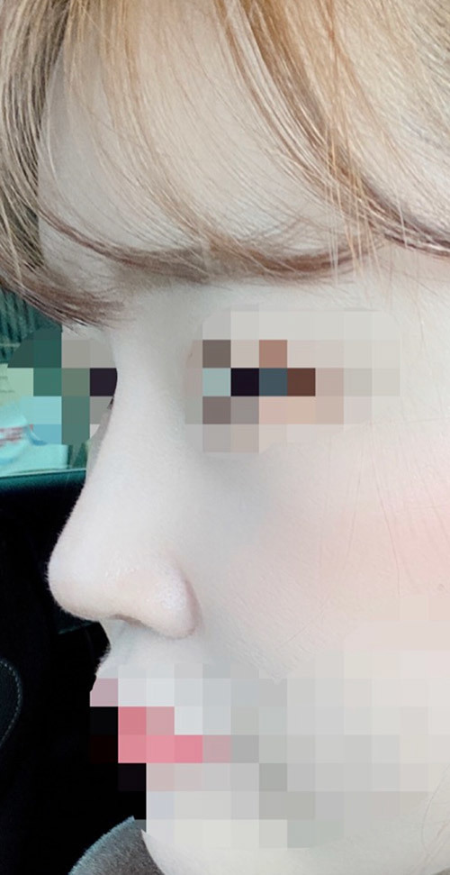 [鼻] シャブ - 鼻