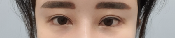 [目] キメン - 目