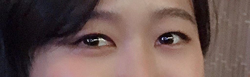 [目] サルセラ - 目