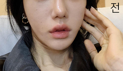 [皮膚]リングリドンドン - エアージェットリフティング