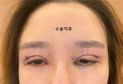 [目] なりなり - 目