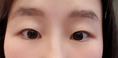 [目] メガロドン - 目