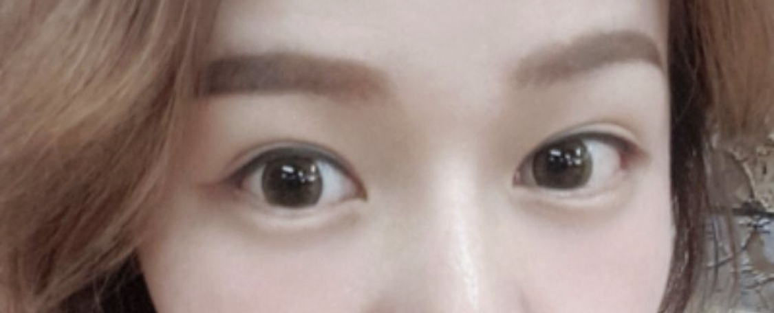 [目] 思い通りにしてください - 目尻切開、グラマラスライン形成