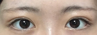 [目] クォン・ドンハ - 目