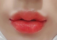 [プチ] ダヒイン - フィラー