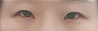 [目] 핑구찐 - 目