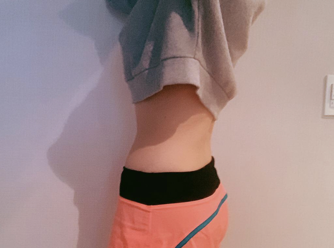 [脂肪吸引] yedu87 - 脚、腹部の脂肪吸引