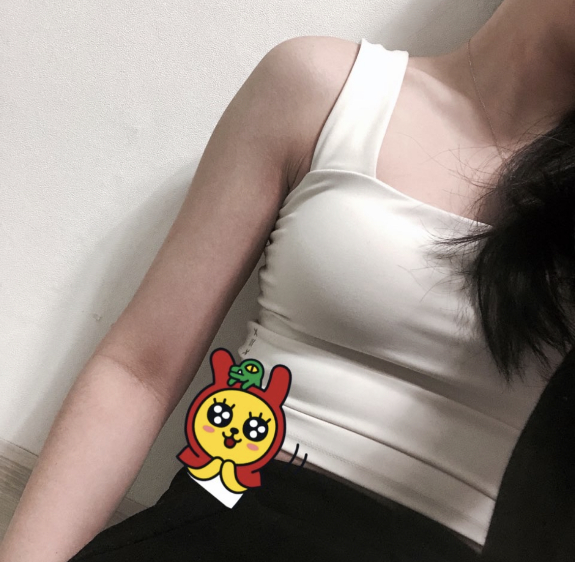 [脂肪吸引] 힘들어요 - 腕の脂肪吸引