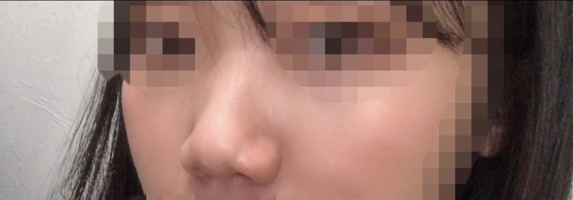 [鼻] どうして電話に出ないの - 鼻