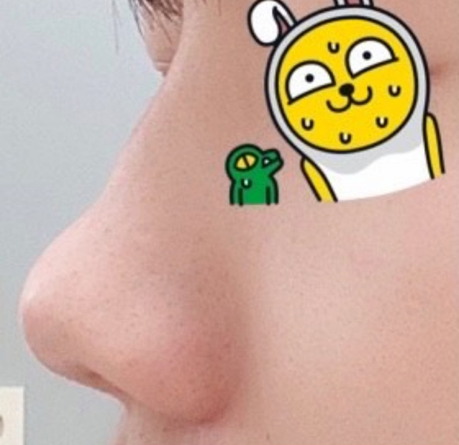 [鼻] ビションションションショル - 鼻