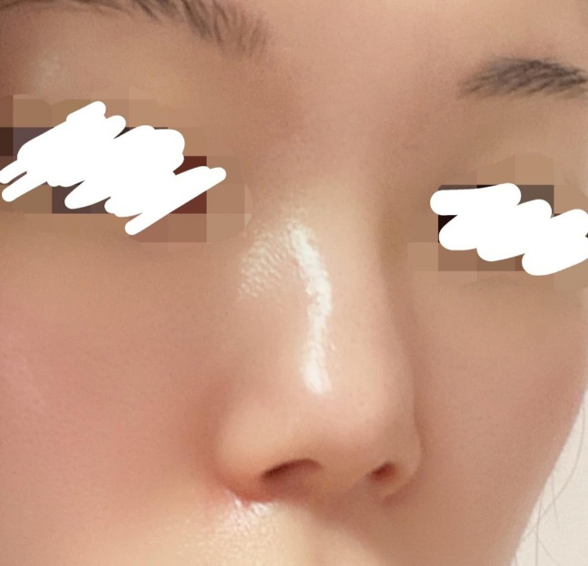 [鼻] ヨムイ쓰 - 鼻