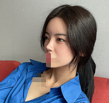 [鼻] ウィベア - 鼻