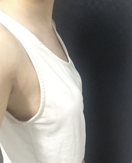 [胸] 午後2時 - 胸