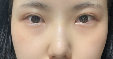 [目] 怒った - 目、鼻