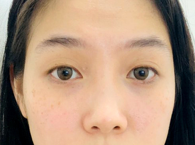 [目] ベットガール - 目、鼻