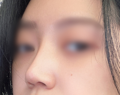 [鼻] 急ブレーキ - 鼻