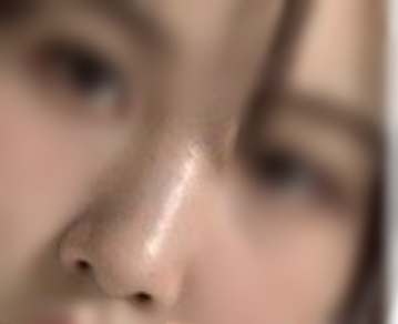 [鼻] 鼻の整形 - 鼻