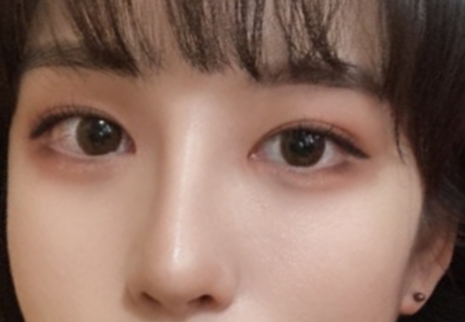 [目] 白いんげん豆 - 目、鼻、輪郭3種、額リフト