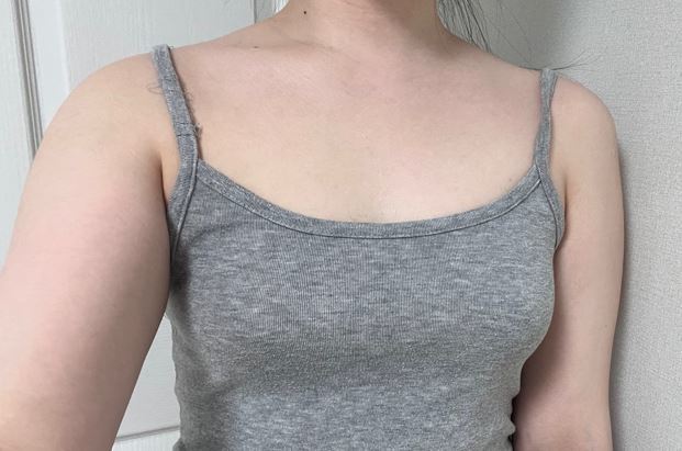 [豊胸] イジェク - 胸